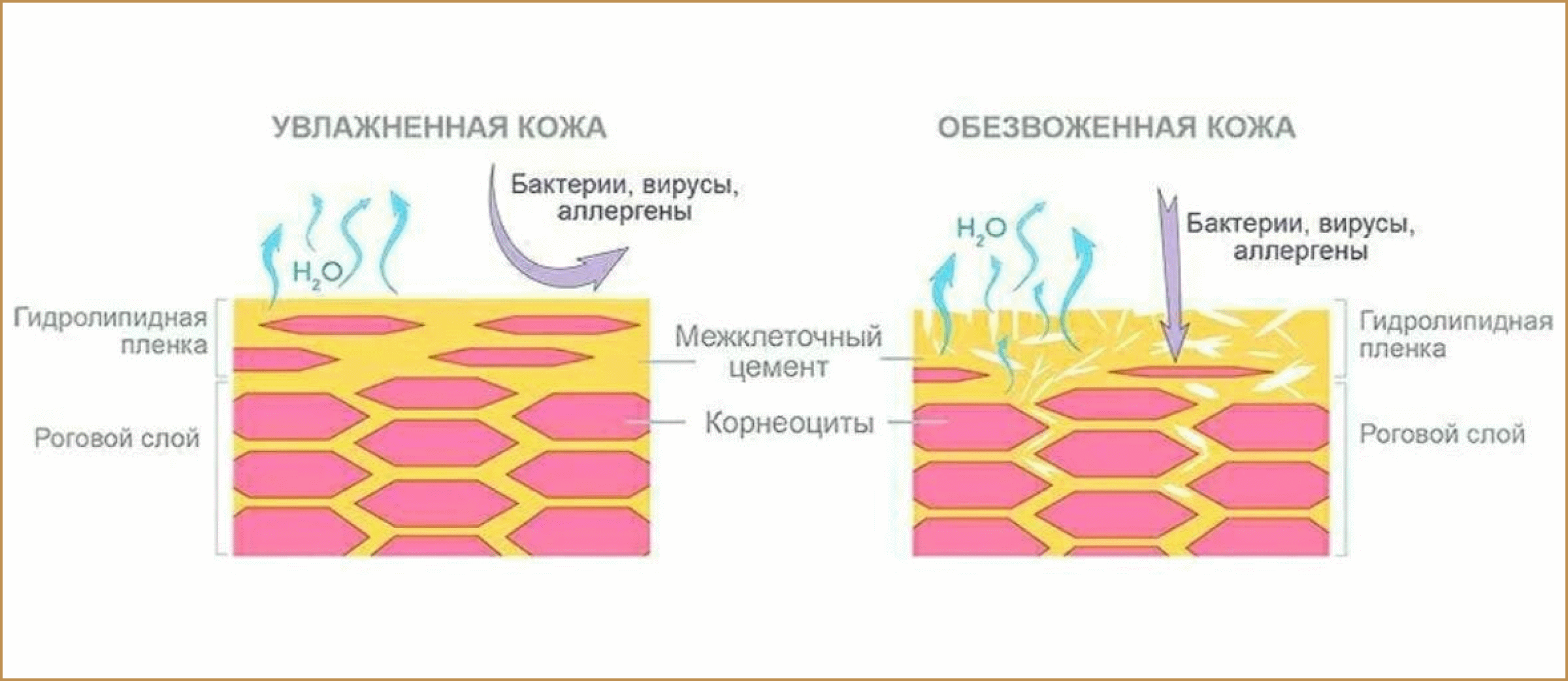 Схема увлажнённая и обезвоженная кожа